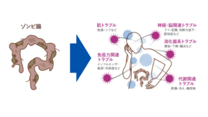 日本人の6割以上が「ゾンビ腸」のリスク、40代以上の女性に多く判明