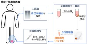 順天堂大、難治性虚血性下肢潰瘍へのRE-01の医師主導治験を開始