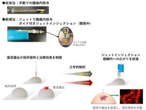 ジェットインジェクション技術による腫瘍内ドラッグデリバリーの研究成果が発表
