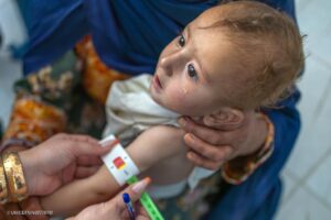 アフガニスタンで2027年に400万人超の子どもが治療必要に ユニセフ等警鐘