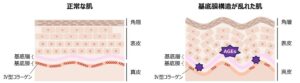 第一三共ヘルスケア、ワレモコウエキスにⅣ型コラーゲン産生量低下の抑制作用を発見