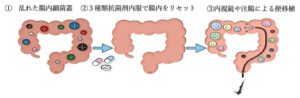 順天堂大など、潰瘍性大腸炎へのA-FMT療法の多施設共同比較試験を開始