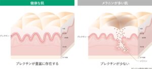 富士フイルム、シミ部位で基底膜が変形することを発見　新リポソームも開発